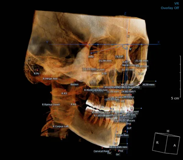 RMM11063009 Dentri Max CBCT (16x18) - RMM Will
