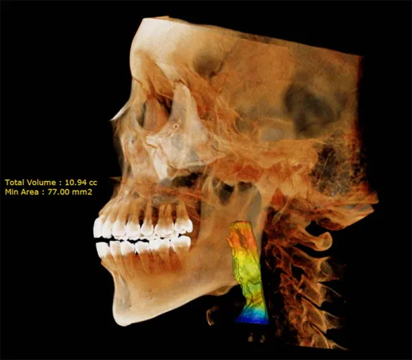 RMM11063009 Dentri Max CBCT (16x18) - RMM Will