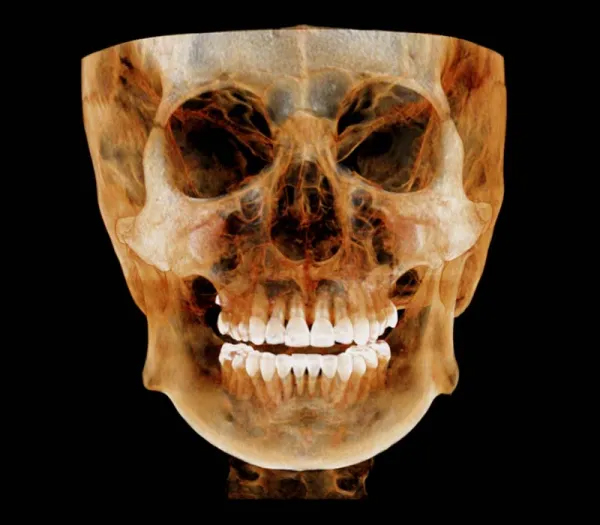 RMM11063009 Dentri Max CBCT (16x18) - rmm